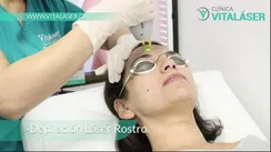 Video cliente feliz con Clínica Vitaláser